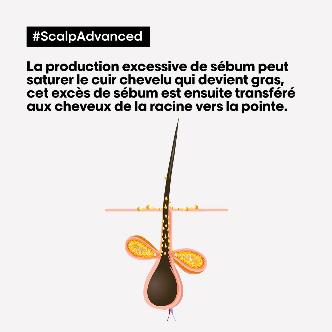 Shampooing Dermo-purifiant Anti Gras Scalp Advanced L'Oréal 1500ml 6 Shampooing Dermo-purifiant Anti Gras Scalp Advanced L'Oréal 1500ml – Image 4