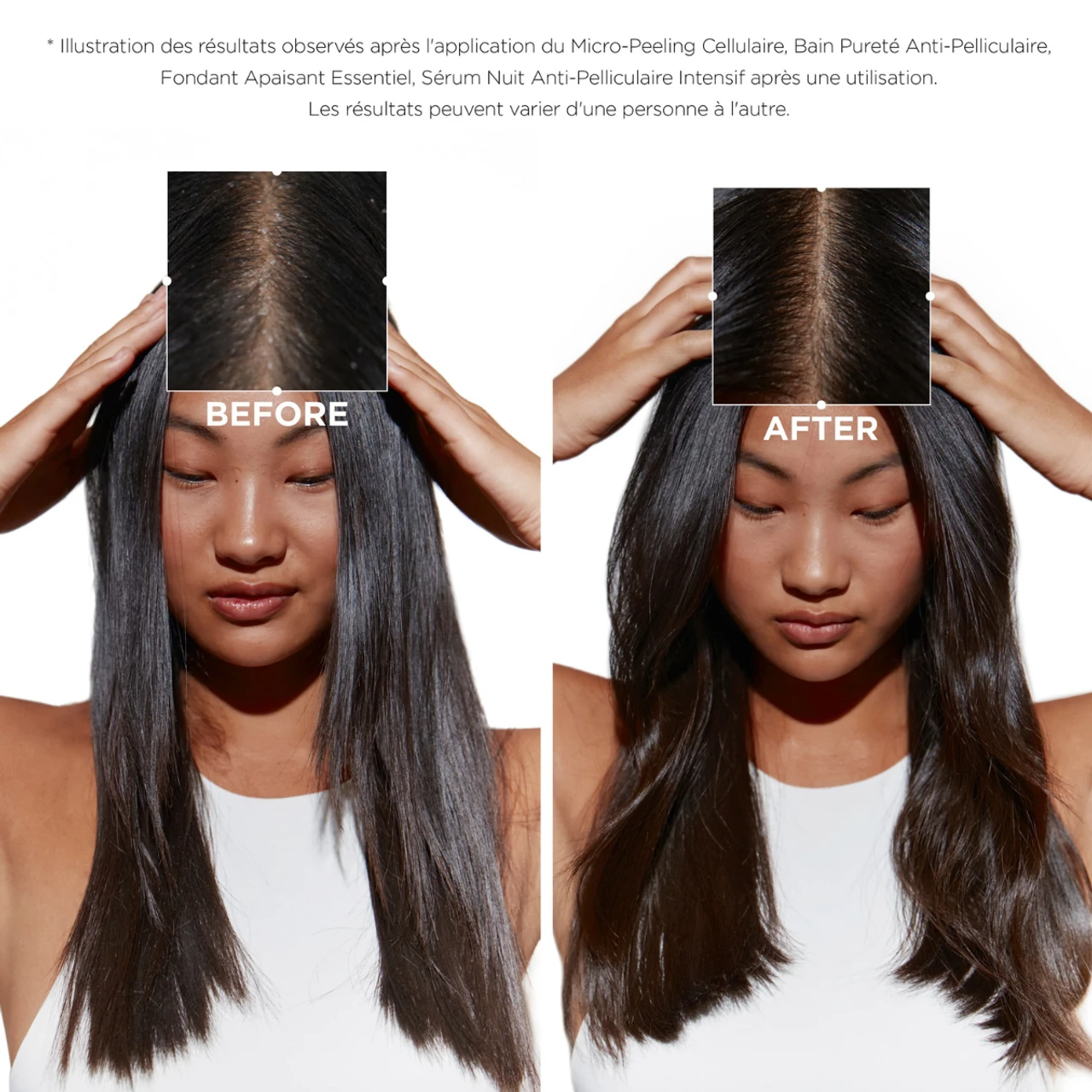 Micro-Peeling Cellulaire Symbiose Kérastase 200ml 5 Micro-Peeling Cellulaire Symbiose Kérastase 200ml – Image 3