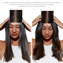 Sérum Cellulaire Nuit Anti-Pelliculaire Intensif Symbiose Kérastase 10 Sérum Cellulaire Nuit Anti-Pelliculaire Intensif Symbiose Kérastase -Beauté Naturelleac Magasin Sans titre 350 350 px 500 500 px 280 280 px 140 140 px 350 350 px 1200 1200 px 19 31693.1684847701