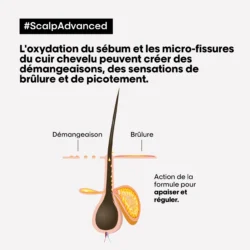 Shampooing Anti-Inconfort Scalp Advanced L'Oréal 1500ml 10 Shampooing Anti-Inconfort Scalp Advanced L'Oréal 1500ml -Beauté Naturelleac Magasin scalp adavanced antiinconfort 17500.1684847770